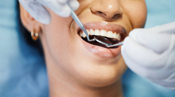 Best Emergency Broken Tooth Repair in Sunrise Beach Village, TX
