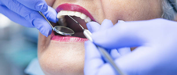 Best Emergency Wisdom Teeth Removal in Sunrise Beach Village, TX
